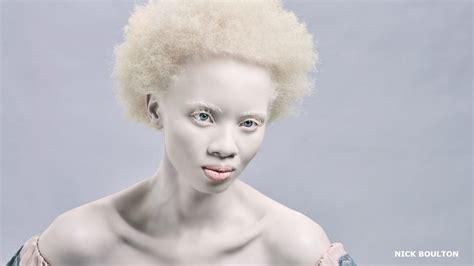 Naked Erika Eleniak. . Black albino pussy